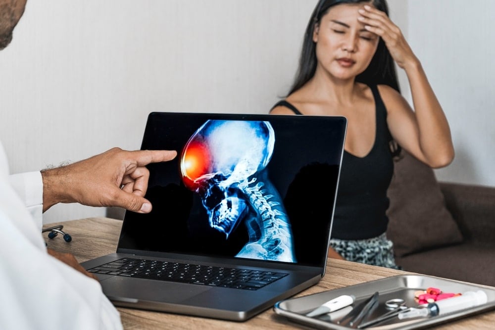 Brain Injury Doctor Pointing On Head Scan Of A Woman On The Computer