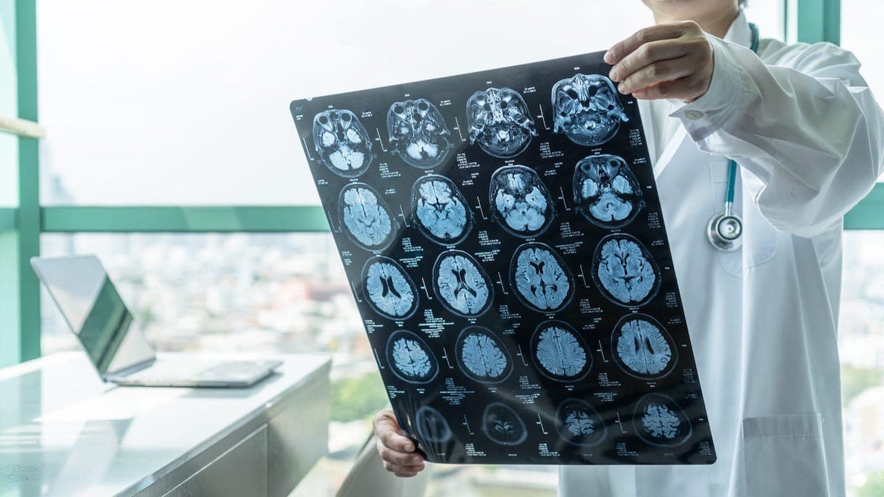 Brain X-Ray